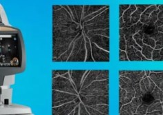 OCT Angiography