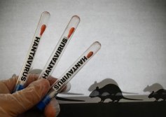 لقاحات mRNA